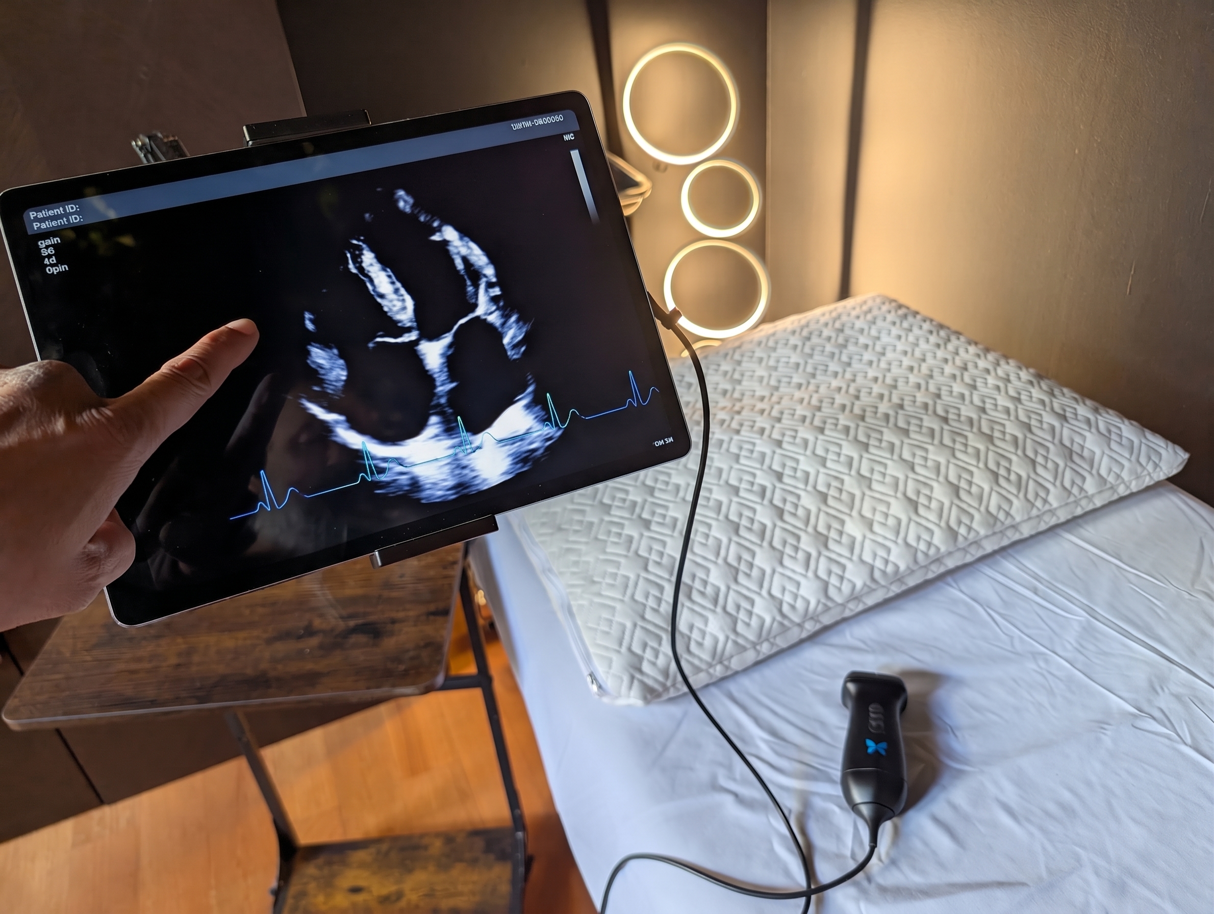 Cardiac ultrasound display and probe beside the examination table